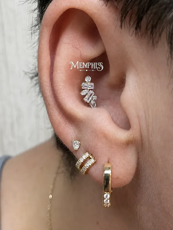Helix duplo com cristais alinhados na cartilagem